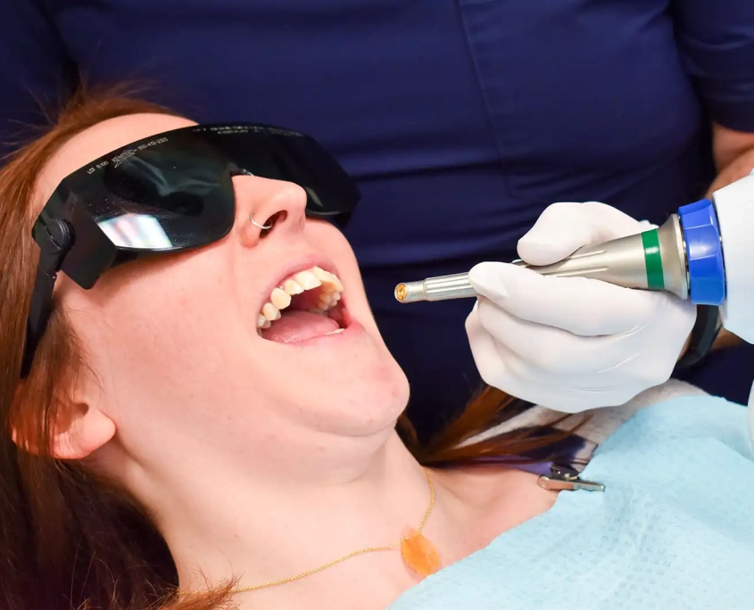 Velescope laser oral screening