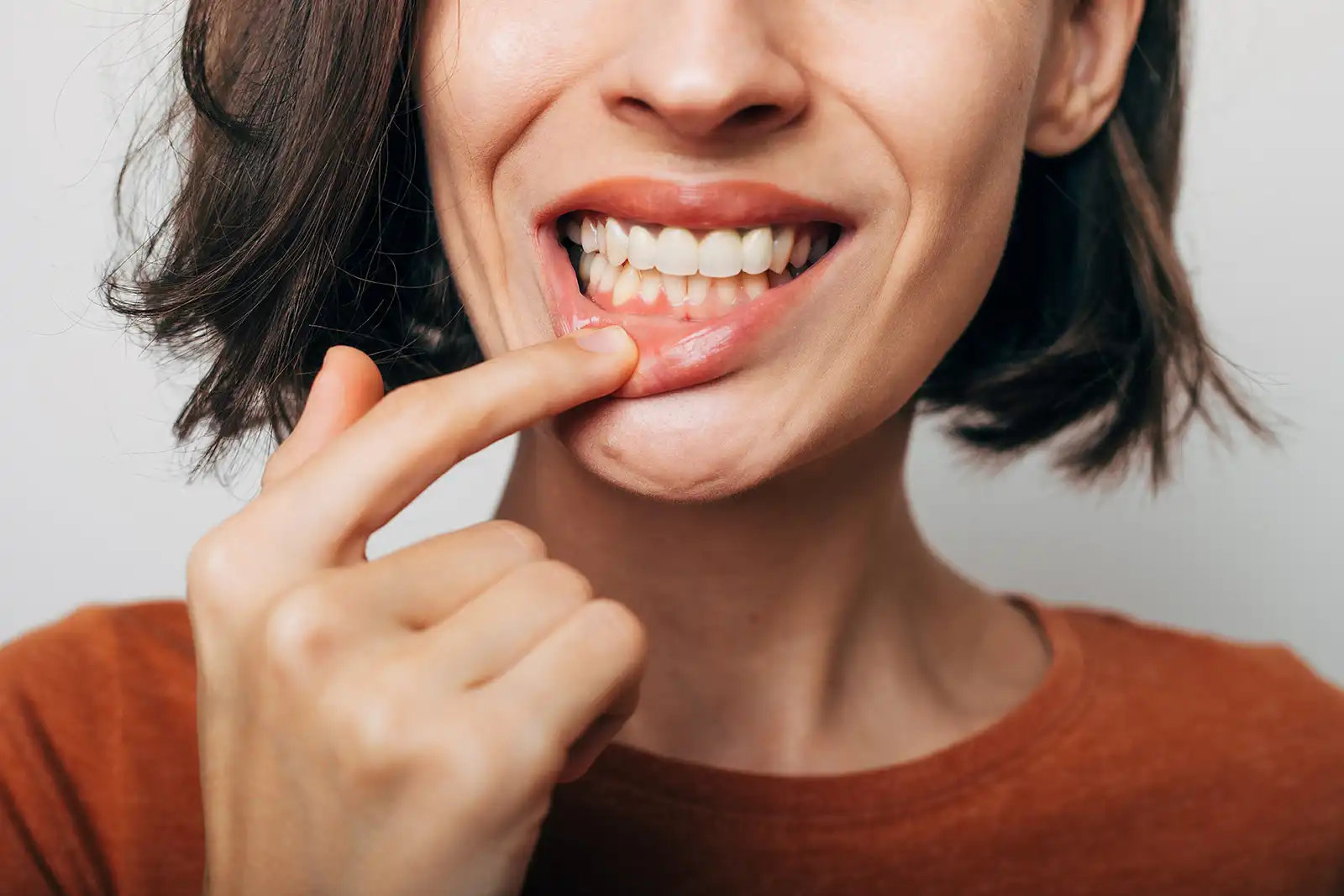 Gum disease can be just as destructive to the teeth as cavities. Woman showing her gum disease