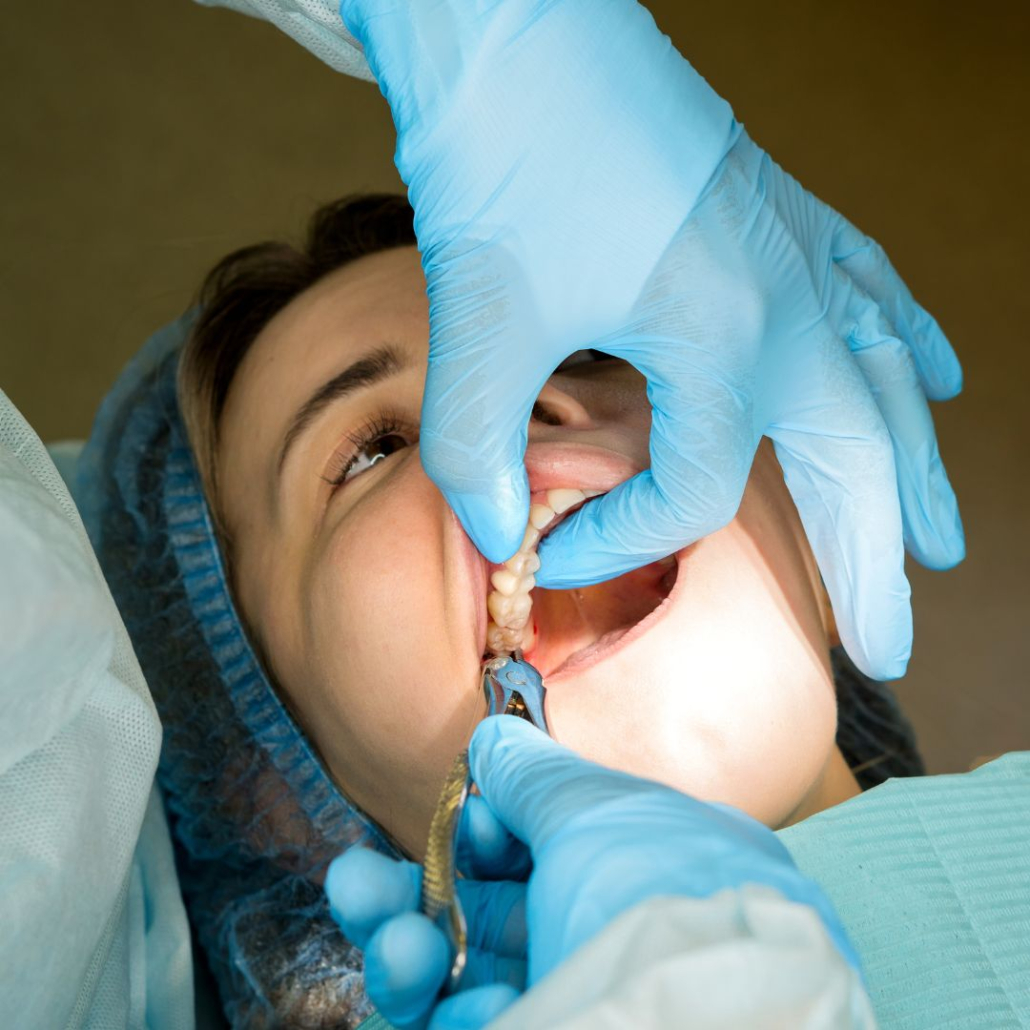 Patient getting a tooth extraction.