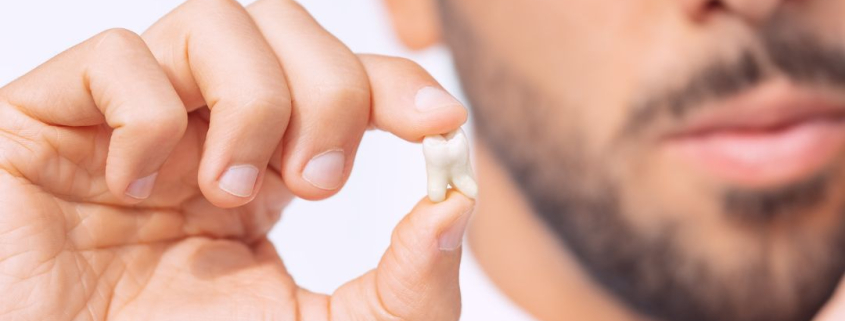 Man holding broken tooth.