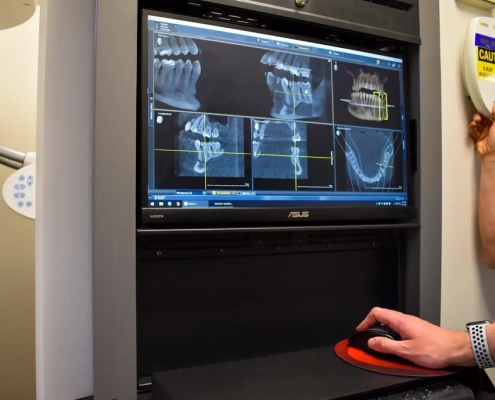 3D Dental Imaging at Hudson Family Dental In Hudson, MA.