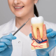 a female doctor holding a decayed tooth with visible cavities and a dental tool, emphasizing the importance of periodontal treatments for maintaining gum health.