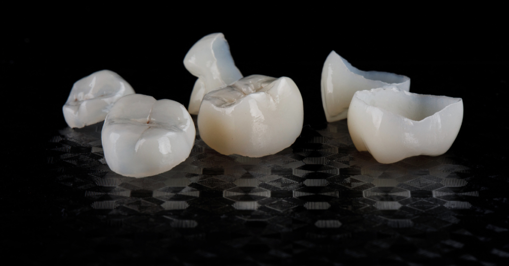 Photo of same-day dental crowns. 