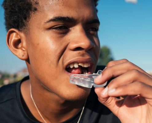 Athlete putting on dental protection for athletes.