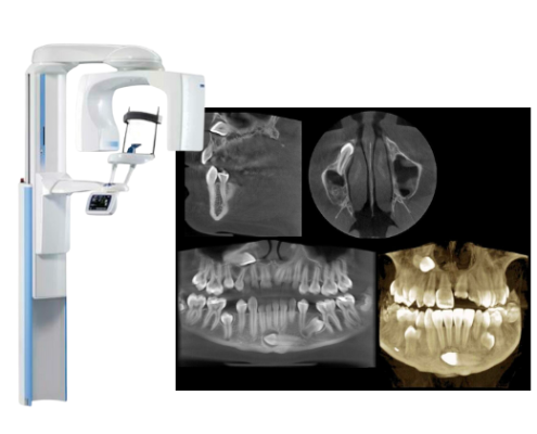 Modern CBCT machine showing detailed 3D dental X-ray scans.