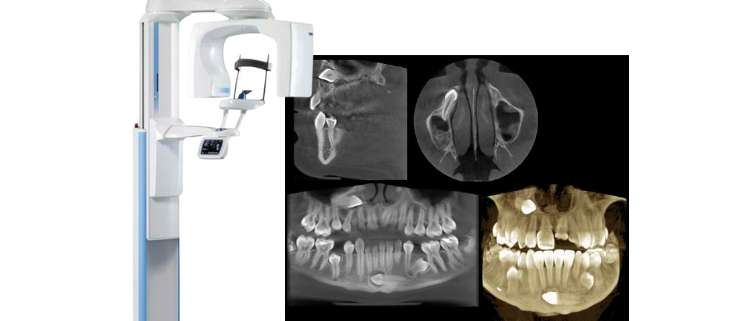 Modern CBCT machine showing detailed 3D dental X-ray scans.