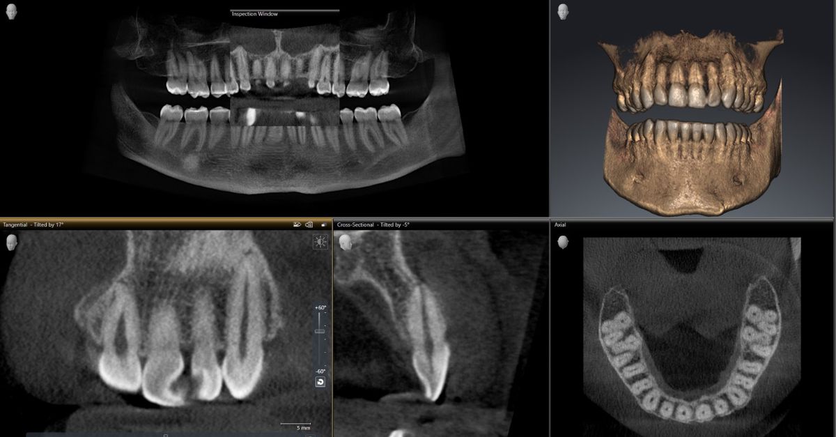 High-tech dental CBCT machine with 3D X-ray results for safe and accurate dental health screening.