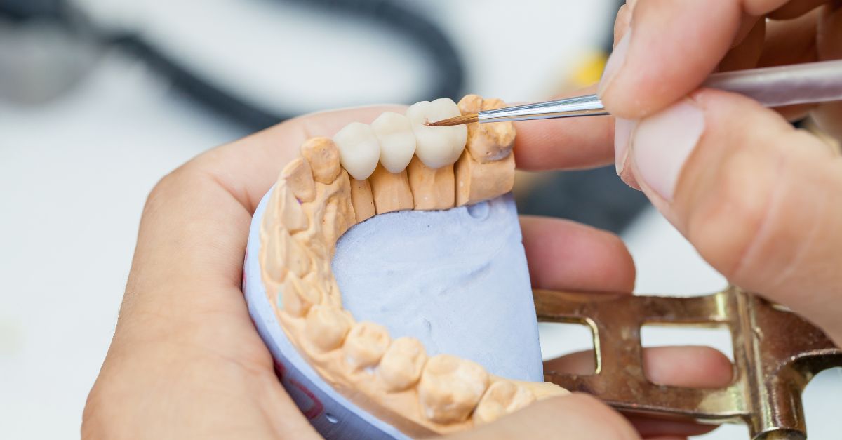A dental technician using a fine brush to detail a prosthetic dental bridge on a stone model.
