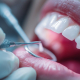 A dentist using professional tools to examine a patient's healthy dental implants and teeth.